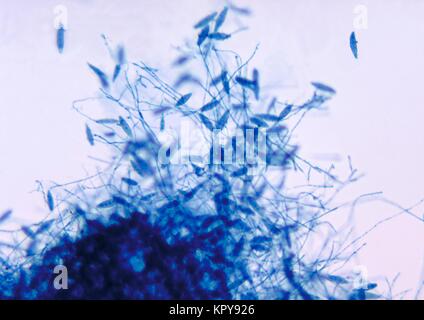 C'est une photomicrographie du champignon Microsporum gypseum en utilisant la technique de coloration bleu coton lactophénol. Le M. gypseum dermatophyte, un sol naturel, habitant peut causer et tinea corporis tinea capitis chez les humains et les animaux, 1969. D'autres les dermatophytes sont inclus dans les genres Trichophyton et Epidermophyton . Image courtoisie CDC/Dr. Théâtre Leanor Haley. Banque D'Images