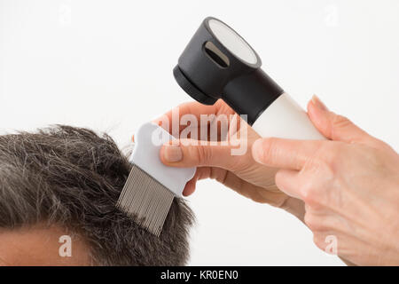 Personne avec des cheveux du patient examen Dermatoscope Banque D'Images