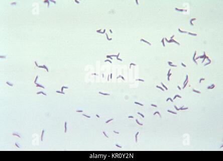 Cette microphotographie montre la bactérie à Gram positif Eubacterium alactolyticum cultivés dans la gélose au sang pendant 48 heures, 1972. E. alactolyticum, maintenant nommée Pseudoramibacter alactolyticus, est un anaérobie, tige non sporulée. Normalement, cette bactérie peut être trouvé inhabiiting la cavité buccale, et est souvent impliqué dans la maladie parodontale-related conditions pathologiques. Image courtoisie CDC/Bobby forte. Banque D'Images