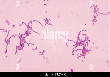 Cette microphotographie montre gram positif Peptostreptococcus spp., 1972. les bactéries, qui sont connus pour se développer dans les formations. Peptostreptococcus spp. sont des bactéries anaérobies, qui sont normalement en cours d'habitants de la peau, l'urètre, et l'appareil uro-génital. En vertu des conditions traumatisantes ou immunodéprimés ces organismes peut devenir pathogène, ainsi que septicémique. Image courtoisie CDC/Dr. Gilda L. Jones. Banque D'Images