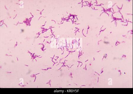 Cette microphotographie montre la bactérie à Gram positif Bifidobacterium eriksonii, 1972. B. eriksonii eriksonii, également appelée Actinomyces, est une bactérie anaérobie, qui est un habitant normal de la cavité orale et n'a normalement pas de causer la maladie. Image courtoisie CDC/Gilda L. Jones. Banque D'Images