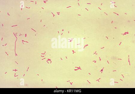 Amplifié 1000X, cette microphotographie montre Bacteroides fragilis subsp, 1974. fragilis bactéries qui avaient été cultivées en bouillon Schaedler ?s, et traitées à l'aide de la méthode de coloration de Gram. Bacteroides fragilis, une bactérie Gram-négatif, constitue 2 % de la microflore bactérienne colique normale chez l'homme. Elle est associée à des infections extraintestinales telles que des abcès et des infections des tissus mous, ainsi que les maladies diarrhéiques. Image courtoisie CDC/Don Stalons. Banque D'Images