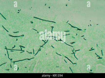 Micrographie d'un cerveau à l'aide d'un pigeon d'argent méthénamine teinté, révélant la présence du champignon Ochroconis gallopavum gallopava Dactylaria, autrefois, 1976. Gallopavum Ochroconis est un champignon, ou apparaissant sombre, ce qui provoque des infections cutanées ou sous-cutanée, et est plus susceptible d'être associé à des infections du SNC qui sont généralement limitées au cerveau. Image courtoisie CDC/Dr. Libero Ajello. Banque D'Images