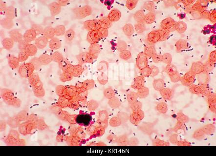 Cette microphotographie montre en forme de cocci Enterococcus sp, 1978. des bactéries provenant d'un patient d'une pneumonie. Enterococcus sp. est une bactérie Gram-positive qui se trouve normalement dans l'intestin et les voies génitales féminines. Ces bactéries peuvent se transmettre par voie fécale-orale, contact avec des liquides organiques infectés ou avec des surfaces contaminées. Image courtoisie CDC/Dr. Mike Miller. Banque D'Images