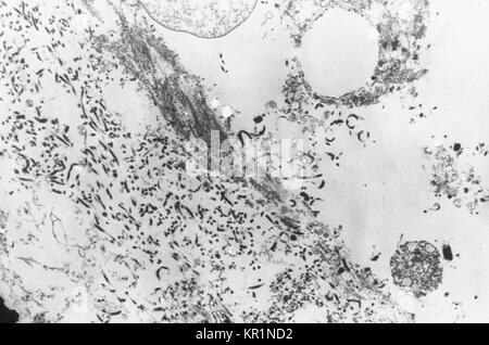 Electronmicrograph montre une section fine contenant le virus Ebola, l'agent causal de la fièvre hémorragique Africaine, 1976. La période d'incubation du virus Ebola varie de 2 à 21 jours avec l'apparition soudaine de la maladie, caractérisée par de la fièvre, maux de tête, des douleurs musculaires et des maux de gorge, faiblesse, et, suivi de la diarrhée, des vomissements et des douleurs à l'estomac. Image courtoisie CDC/Dr. Fred Murphy. Banque D'Images