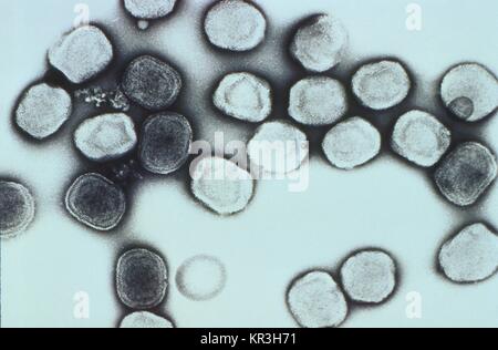 Cette micrographie électronique à transmission (TEM) décrit un certain nombre de virus de la vaccine, 1981. Un virion est un unique, complet et particules virales infectieuses. Le virus de la vaccine est normalement limitée au bétail, mais est transmis aux humains par la vaccination, ce qui, ce qui confère l'immunité contre la variole le virus variolique. Image courtoisie CDC/Dr. Erskine Palmer. Banque D'Images