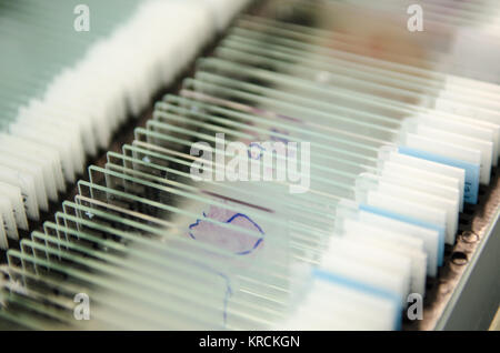 Un grand nombre de racks de tenir les lames de microscope contenant la biopsie des tissus du patient test dans un laboratoire de pathologie de diagnostic. Banque D'Images