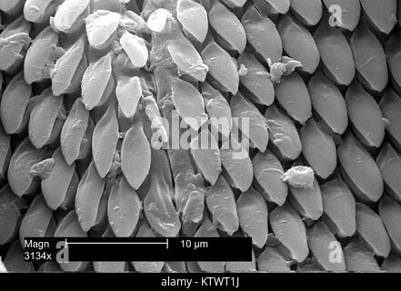 Cette micrographie électronique à balayage (MEB) nous montre une vue agrandie de la bouche des parties d'une tique américaine du chien, Dermacentor variabilis, amplifié 3134X. Les tiques sont de la classe des Arachnides, comme les araignées et les acariens sont, 2002. D. variabilis est un porteur connu de la fièvre pourprée des montagnes causée par la bactérie Rickettsia rickettsii . Image courtoisie CDC. Banque D'Images