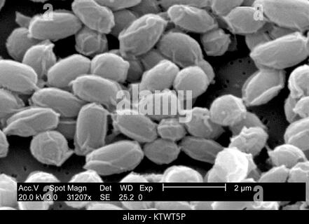 Sous un très haut niveau d'agrandissement de 31, 207X, cette l'analyse des électrons Microphotographie (SEM) dépeint les spores de la souche Sterne de bactéries Bacillus anthracis. Pour une version colorisée de cette image voir PHIL 10023. L'une des principales caractéristiques de la souche Sterne de B. anthracis est la surface ridée de la protéine coat de ces spores bactériennes. Ces spores peuvent vivre pendant de nombreuses années, qui permet à la bactérie de survivre dans un état dormant. Image courtoisie CDC/Laura Rose, 2002. Banque D'Images