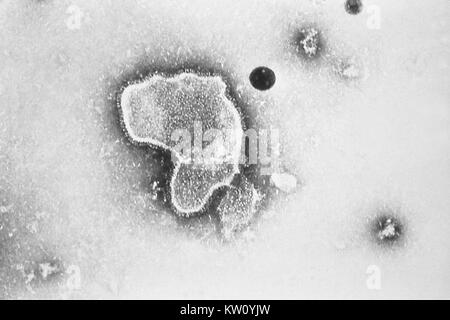 Cette micrographie électronique à transmission (TEM) révèle les caractères morphologiques de la Virus respiratoire syncytial (VRS). Le virion est variable dans la forme et la taille (diamètre moyen de entre 120-300nm). Le VRS est la cause la plus commune de la bronchiolite et la pneumonie chez les nourrissons et enfants de moins de 1 an. Image courtoisie CDC/E. L. Palmer, 1981. Banque D'Images
