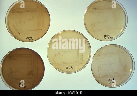 Cette image illustre cinq pétri de plaques de culture qui avaient été remplis d'un milieu à base d'agar, extrait de levure, la cystéine, et pyrophosphate ferrique, à laquelle des concentrations élevées de D- ou L-tyrosine, ou D- ou L-phénylalanine a été ajouté. Ces plaques ont été inoculés avec des cultures de diverses souches de Legionella pneumophila . Notez que le ?browning ? Du milieu s'était produit lorsque L. pneumophila a été cultivé en présence de fortes concentrations de L-tyrosine et, dans une certaine mesure L-phénylalanine, mais pas quand le brunissage D-isomères étaient inclus dans le mélange. Remarque PHIL 2135, 15259 Banque D'Images