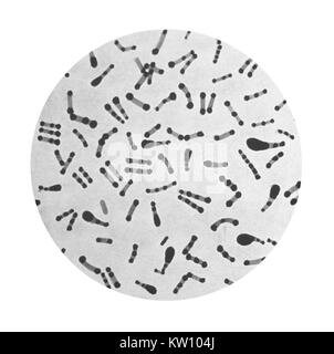 Cette illustration présente une vue photomicrographique de Corynebacterium diphtheriae prises à partir d'une culture de 18 heures, et à l'aide de Albert. Corynebacterium diphtheriae entraîne la diphtérie qui affecte les voies respiratoires supérieures, où un exsudat inflammatoire provoque une grave entrave à la respiration airways, et parfois la suffocation. Image courtoisie CDC, 1979. Banque D'Images