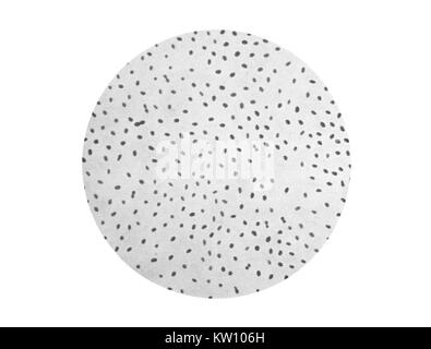 C'est une illustration d'une photomicrographie de la bactérie Brucella melitensis, initialement nommée Micrococcus melitensis . C'est une photomicrographie de Brucella melitensis, la cause de la brucellose. Les symptômes sont semblables à ceux de la grippe et peut également inclure des infections graves du système nerveux central, et la membrane du cœur, ou de l'endocarde. Image courtoisie CDC, 1979. Banque D'Images