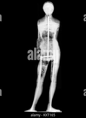 Sculpture petite danseuse âgée de quatorze ans par Edgar Degas (1878-1881), représentant une jeune danseuse de ballet dans une pose naturelle, remarquable pour son réalisme et son innovation dans la sculpture moderne. Banque D'Images