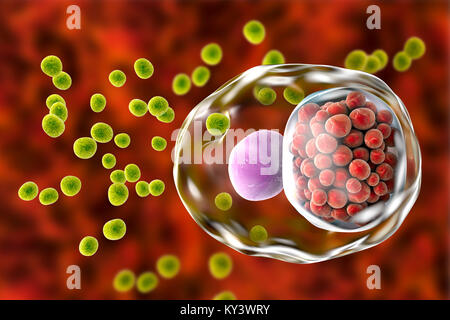 L'infection à Chlamydia. Illustration d'ordinateur d'une cellule infectée par la bactérie Chlamydia trachomatis. Corps élémentaires (EBs, les petites sphères vertes), la non-infectieuses reproduisant la forme des bactéries sont vus à l'extérieur de la cellule hôte. La cellule et l'infecter EBs sont transformés en corps réticulés (RB), qui sont se répliquer. RBs sont perçues comme un groupe de petites sphères rouges près du noyau (violet) de la cellule. La chlamydia est une infection transmise sexuellement qui peut passer inaperçue provoquant l'infertilité. Il provoque aussi la maladie de l'oeil le trachome, qui peut conduire à la cécité. Banque D'Images