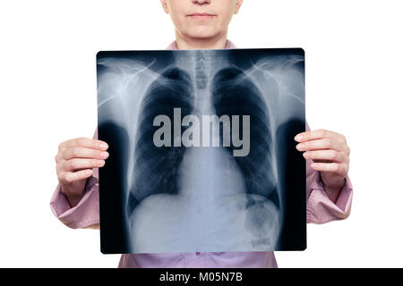 Femme tenant une radiographie en avant de son corps Banque D'Images