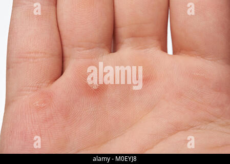 Macro d'ampoule sur les droits de la race blanche Banque D'Images