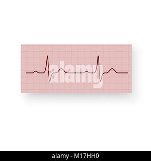 La fréquence cardiaque ou d'une pulsation sur un papier de traçage. Cardiogramme du coeur sur un papier millimétré. Cardiogramme d'un cœur en santé. Vector illustration isolé o Illustration de Vecteur