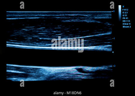 L'image colorée d'échographie modernes moniteur. Machine à échographie. La haute technologie de l'équipement médical et de soins de santé. D'une échographie ou sonogra Banque D'Images