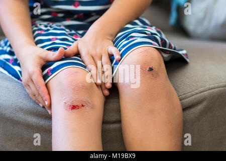 Close-up of little girl holding meurtri son genou endommagé blessé avec ses mains Banque D'Images