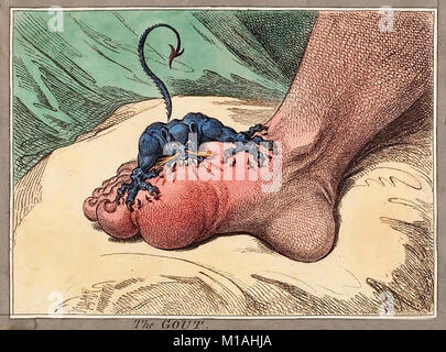 Le gout de James Gillray - Illustration montrant la douloureuse crise de goutte Banque D'Images