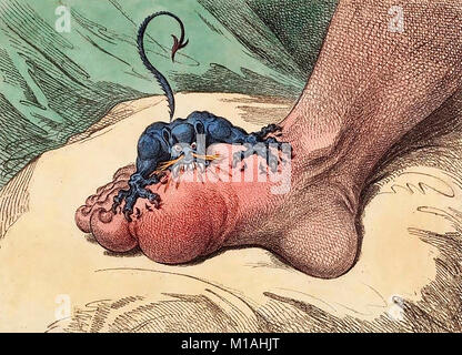 Le gout de James Gillray - Illustration montrant la douloureuse crise de goutte Banque D'Images