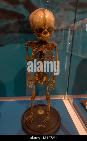 Les droits de l'enfant squelette fœtal à l'âge de 9 mois sur l'affichage dans le Musée National de la santé et de la médecine, Silver Spring, MD, USA. Banque D'Images