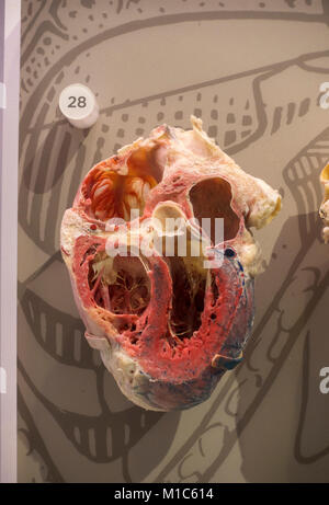 Plastinated un coeur sur l'affichage dans le Musée National de la santé et de la médecine, Silver Spring, MD, USA. Banque D'Images