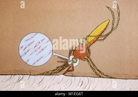 Illustration couleur d'une propagation de l'Anopheles paludisme en transmettant les sporozoïtes tout en se nourrissant de sang humain, y compris une vue agrandie des sporozoïtes, 1976. Image courtoisie CDC. () Banque D'Images