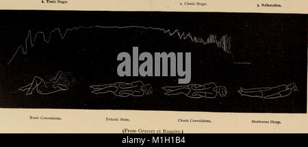 Un travail complet de 1905 sur les maladies nerveuses chez l'enfant, destiné à la fois aux médecins et aux étudiants. Ce traité fournit une exploration approfondie des causes, des symptômes et des options de traitement des troubles nerveux pédiatriques. C'est un texte fondamental dans l'étude de la neurologie infantile. Banque D'Images