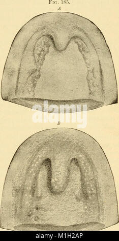 Un texte-livre sur les maladies de l'oreille, du nez et de la gorge (1901) (14593282630) Banque D'Images