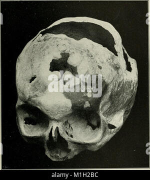 La pratique américaine de chirurgie - un système complet de l'art et la science de la chirurgie (1906) (14595859287) Banque D'Images