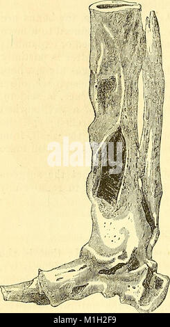 Un système de chirurgie - physiopathologiques, diagnostiques, thérapeutiques, et les (1866) (14781738875) Banque D'Images