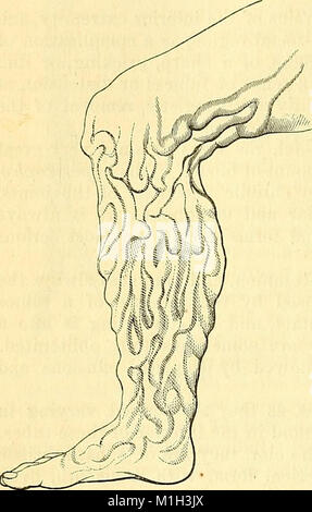 Un système de chirurgie - physiopathologiques, diagnostiques, thérapeutiques, et les (1866) (14778566131) Banque D'Images