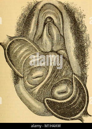 Un manuel de référence de la médecine - ce qui englobe l'ensemble des connaissances scientifiques et pratiques de la médecine et des sciences connexes (1885) (14783972602) Banque D'Images