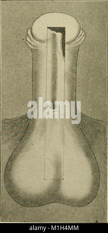 Un nouveau manuel de chirurgie, civils et militaires (1917) (14766723685) Banque D'Images