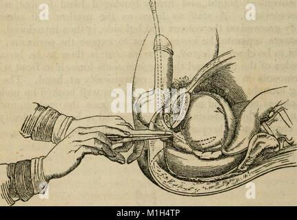 Un recueil analytique des différentes branches de la science médicale, pour l'utilisation et l'examen des étudiants (1848) (18144333776) Banque D'Images