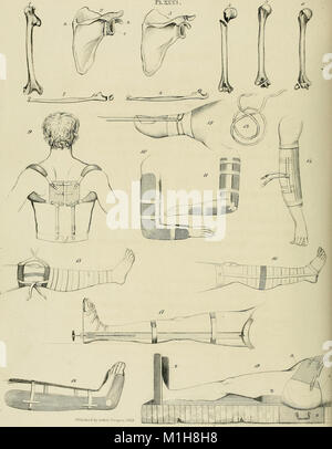 Un traité de luxations et fractures sur des articulations (1824) (14773219911) Banque D'Images