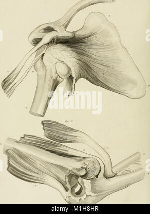 Un traité de luxations et fractures sur des articulations (1824) (14776378765) Banque D'Images