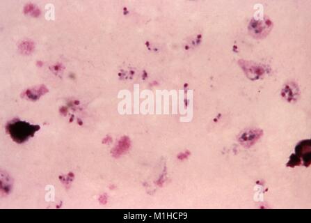 Photomicrographie de paludisme le parasite Plasmodium vivax, causant dans l'anneau et les jeunes formes trophozoïte, sur un frottis sanguin à film épais avec Giemsa, amplifié 1125x, 1971. Image courtoisie CDC/Dr. Mae Melvin. () Banque D'Images