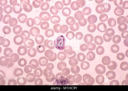 Photomicrographie d'un échantillon de sang à cause du paludisme à P. vivax parasite dans une étape immature, avec 8 masses de chromatine schizonte, avec Giemsa, amplifié 1000x, 1977. Image courtoisie CDC/Dr. Mae Melvin. () Banque D'Images
