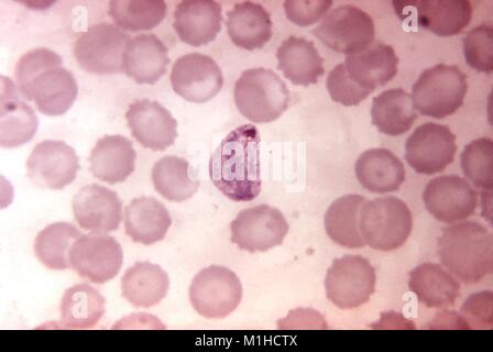 Photomicrographie de plus en plus compacte, Plasmodium vivax trophozoïte, causant le paludisme, un parasite présent sur un frottis sanguin avec Giemsa, amplifié 1250x, 1970. Image courtoisie CDC. () Banque D'Images