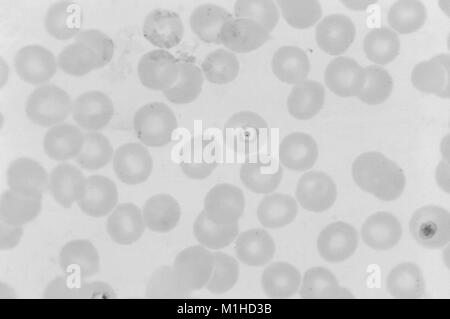 Photomicrographie du parasite du paludisme à Plasmodium vivax en phase avec l'anneau de masse de chromatine dans son centre, le vitrail au Giemsa, film mince amplifié 1125 x 1973. Image courtoisie CDC/Dr. Mae Melvin. () Banque D'Images