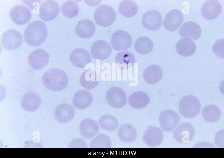 Photomicrographie du parasite du paludisme à Plasmodium vivax en forme de boucle sans points de Schuffner, sur les vitraux de Giemsa, film mince amplifié 1125 x 1973. Image courtoisie CDC/Dr. Mae Melvin. () Banque D'Images