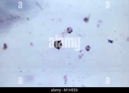 Photomicrographie du parasite du paludisme Plasmodium malariae présente dans ses différents stades de croissance, et schizonte trophozoïte, sur un frottis sanguin mince, 1965. Image courtoisie CDC/Dr. Mae Melvin. () Banque D'Images