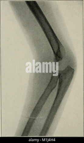 La pratique américaine de chirurgie - un système complet de l'art et la science de la chirurgie (1906) (14782438845) Banque D'Images