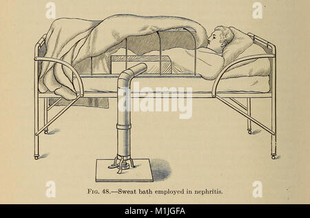 'A Treatise on the Principles and Practice of Medicine' (1916) est un texte médical complet qui décrit les pratiques médicales, les principes et les traitements au début du XXe siècle. Il couvre diverses maladies, traitements et théories médicales de l'époque. Banque D'Images