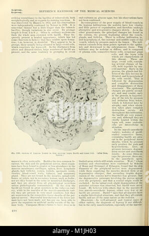 Un manuel de référence de la médecine qui englobe l'ensemble des connaissances scientifiques et pratiques de la médecine et des sciences connexes (1900) (14773221542) Banque D'Images