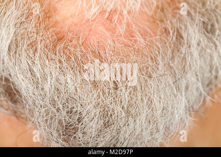 Close up portrait de senior man's barbe grise sur le menton, macro Banque D'Images