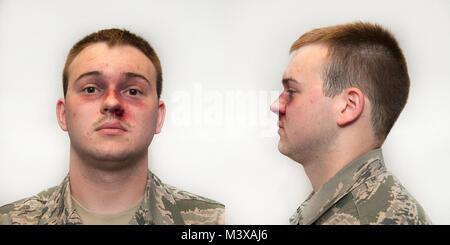 A1C Michael Senkirk, un client Intel Tech Systèmes ACOS, volontaires pour la "Merci pour la campagne demandant à Ramstein AB, Allemagne Le 23 octobre 2014. Moulage du technicien qualifié appliqué à un cosmétique Faciale1C Senkirk's face, afin de simuler une agression contre un membre de la famille. La campagne a été créée par le Centre pour la défense de la famille de Ramstein en association avec la violence au Mois de sensibilisation. (DoD Illustration par SSgt Brian Kimball) A1C Michael Senkirk par DoD Nouvelles Photos Banque D'Images